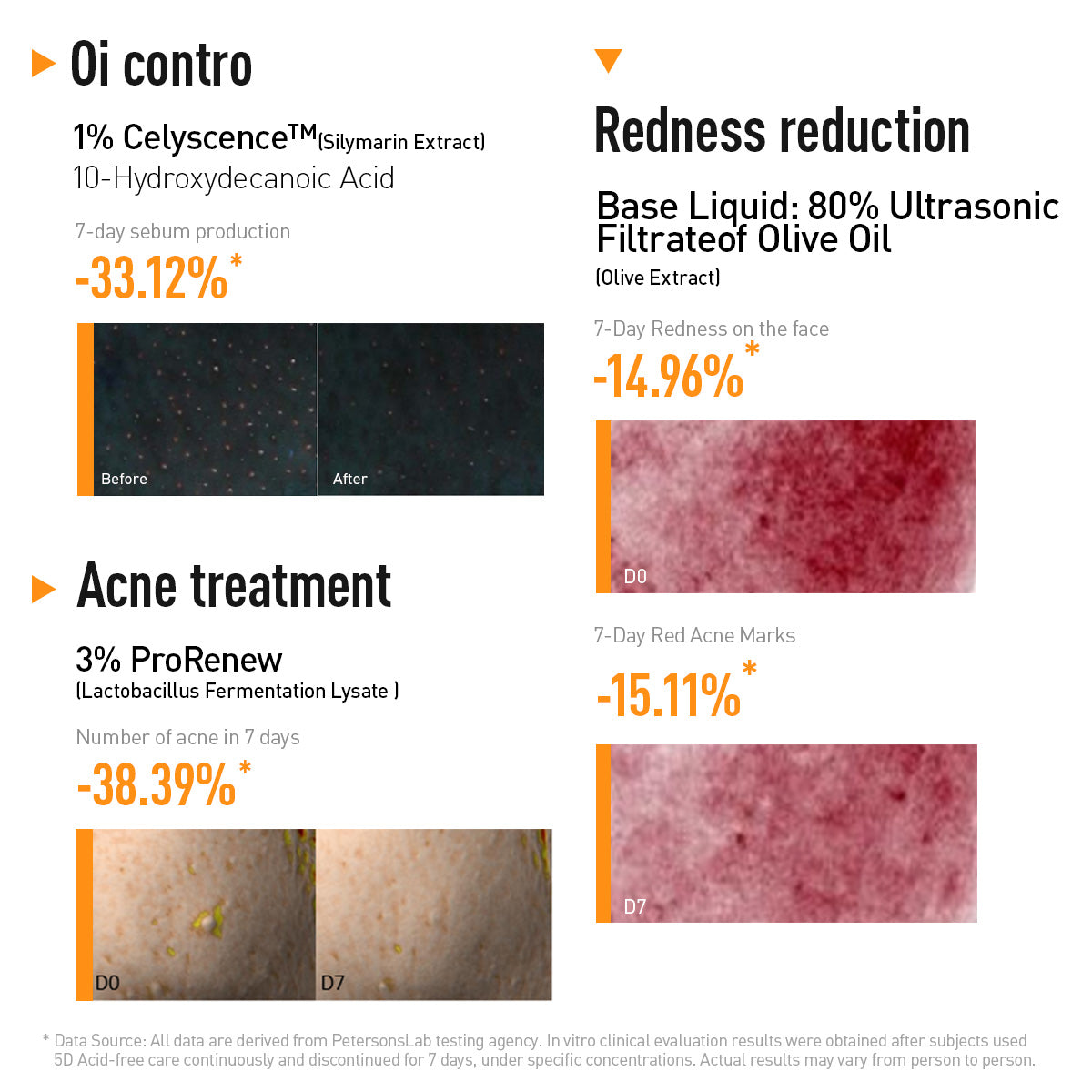 5D ULTIMATE ACNE SOLUTION